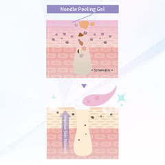 Needle Peeling Gel